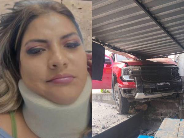 La periodista y candidata a diputada por el Partido Liberal, Saraí Espinal, reapareció en redes sociales con un collarín cervical, heridas en el rostro y una sutura en el labio, luego de haber sufrido un aparatoso accidente en la carretera al sur de la capital el pasado viernes 9 de mayo.